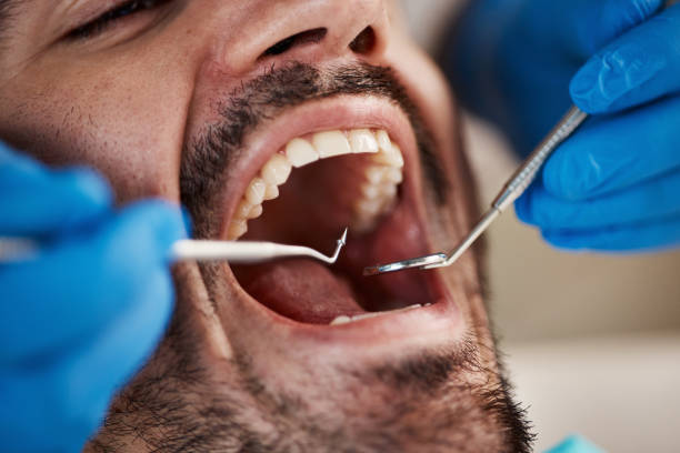 Best Emergency Tooth Extraction in Coalgate, OK